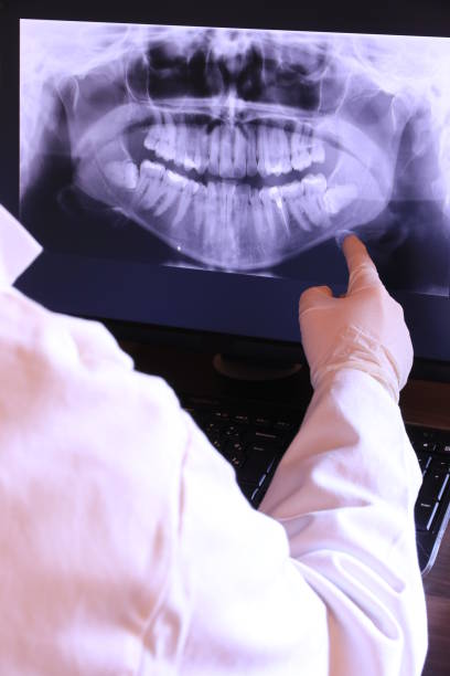Best Emergency Tooth Extraction in Galena, IL