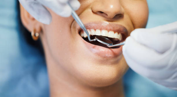 Best Emergency Root Canal Treatment in Galena, IL