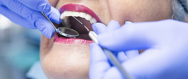 Best Emergency Wisdom Teeth Removal in Galena, IL